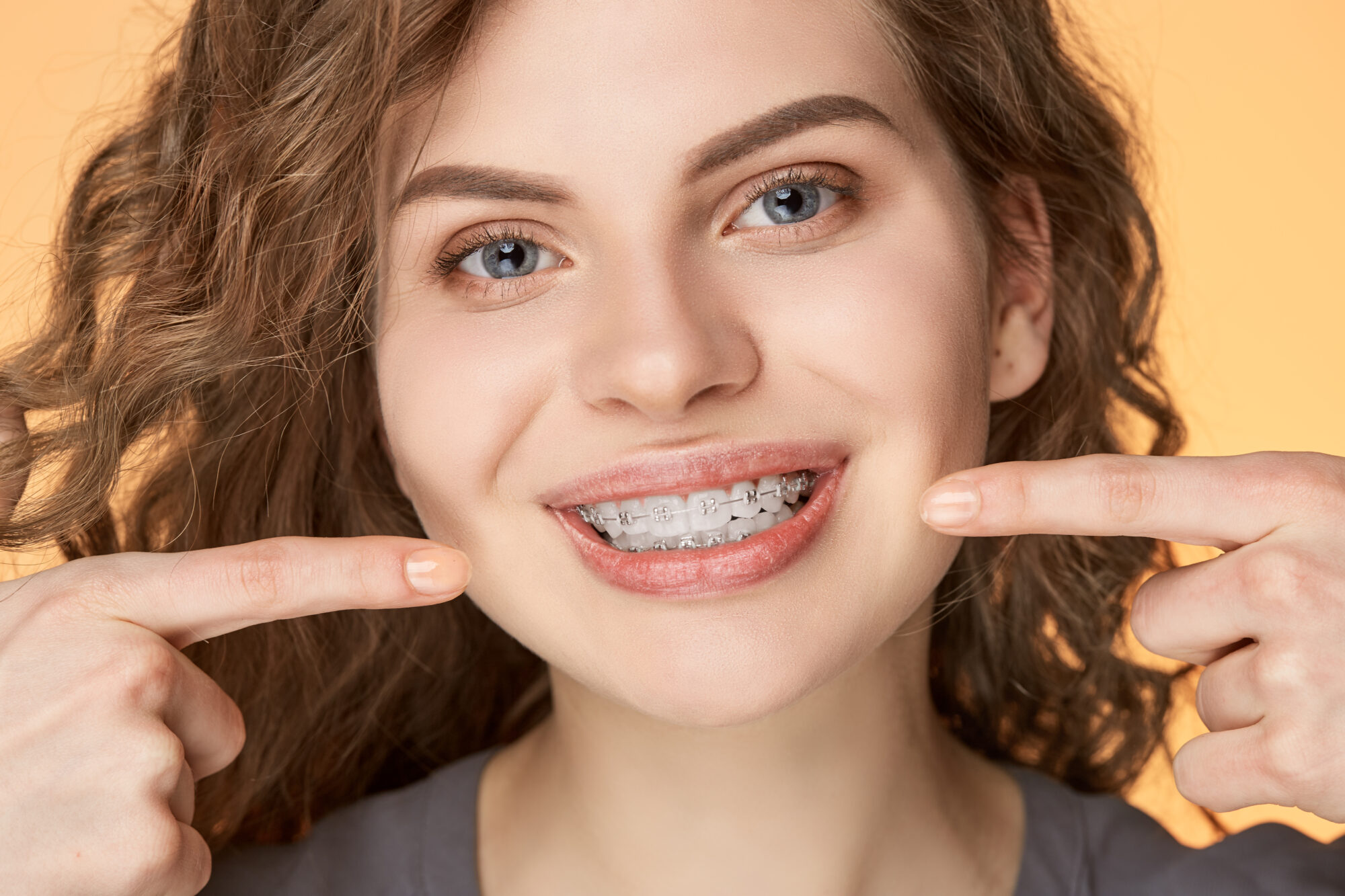 braces sedalia