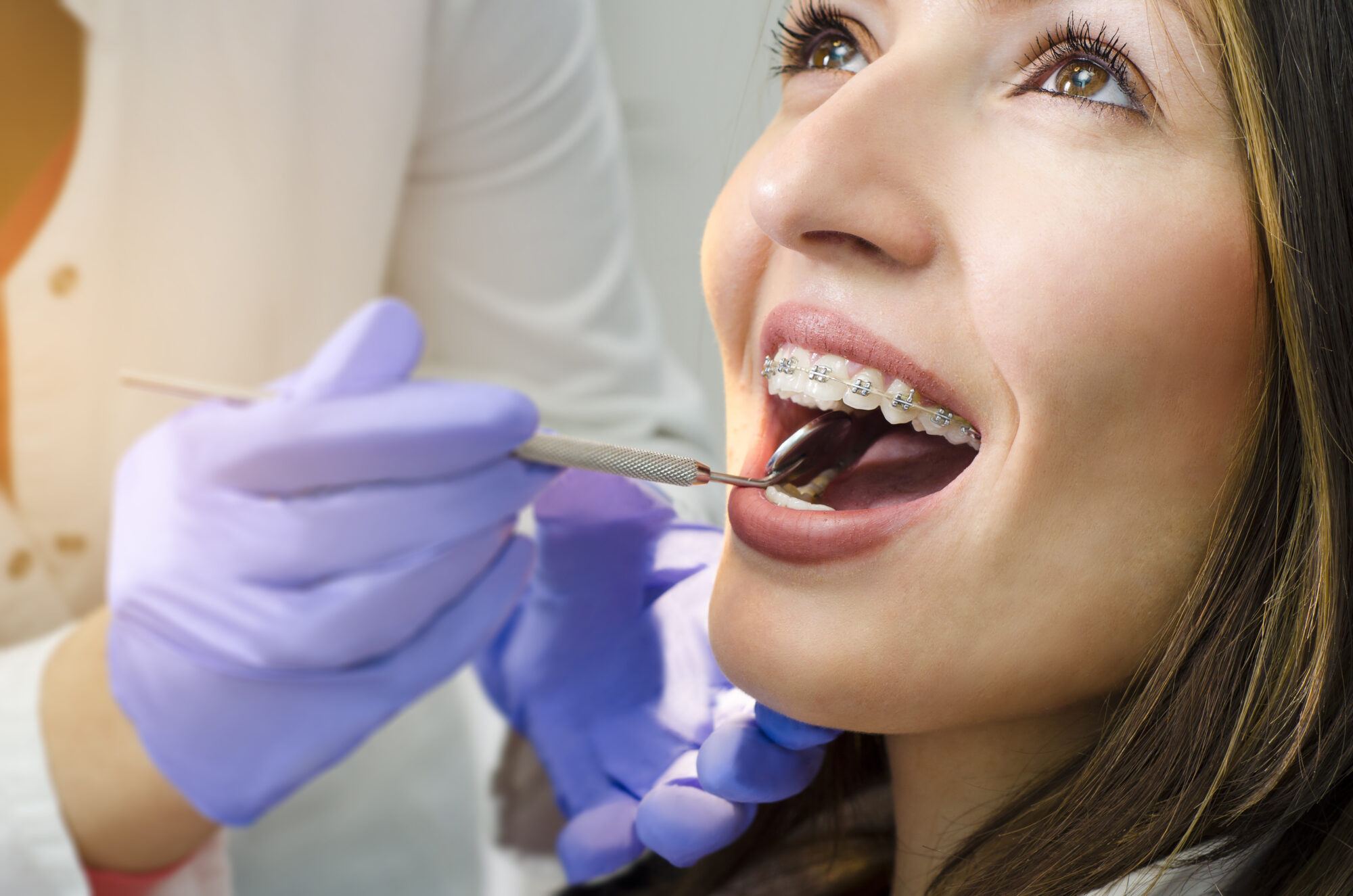 How We Make Orthodontic Treatment Affordable In Kansas City