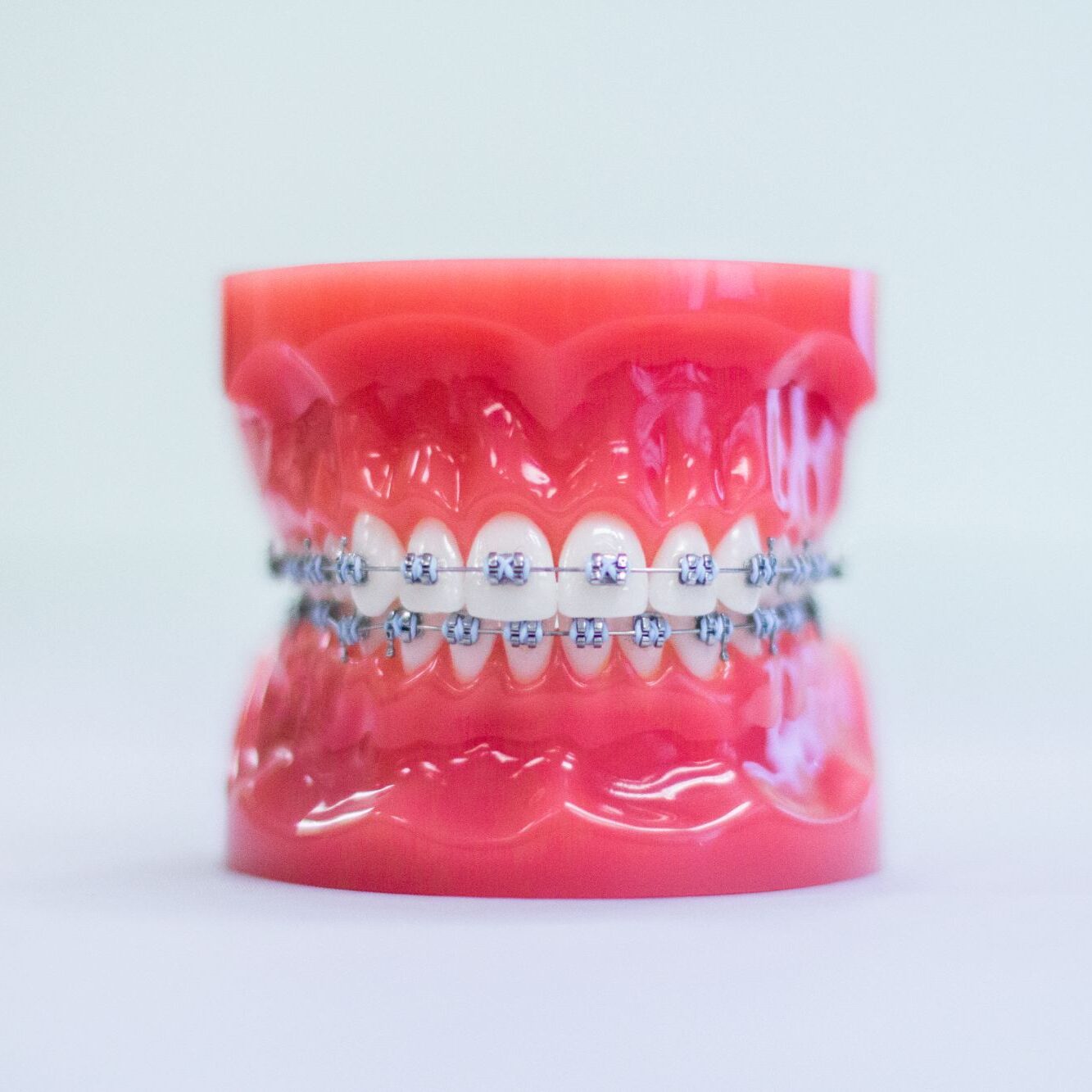 invisalign kansas city